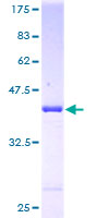 12.5% SDS-PAGE Stained with Coomassie Blue.